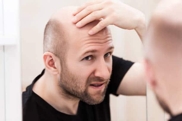balding מוצרים נגד התקרחות תרופה נגד קרחת